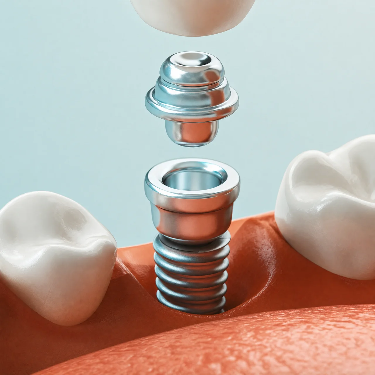 Restauración dental estética